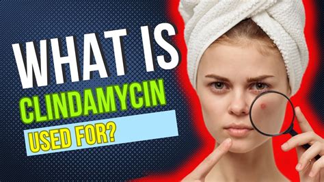 potential side effects of clindamycin