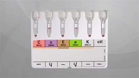 Practical Applications of Blood Typing