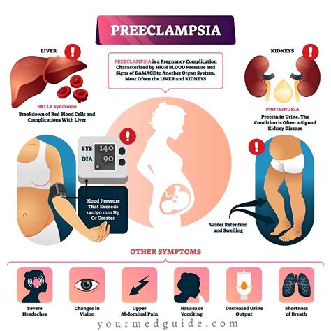 preeclampsia overview