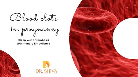 Pregnancy Blood Clots Resources