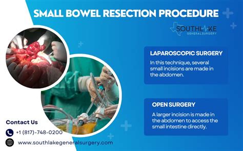 preparation for colon resection surgery