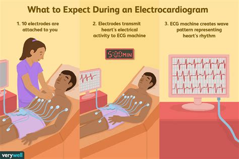 preparing for electrocardiogram