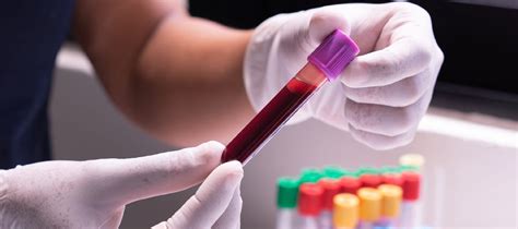 preparing for a blood feces test
