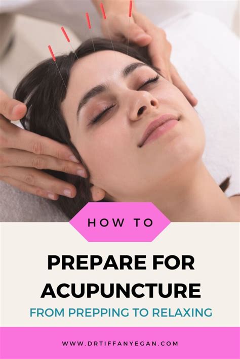 preparing for acupuncture