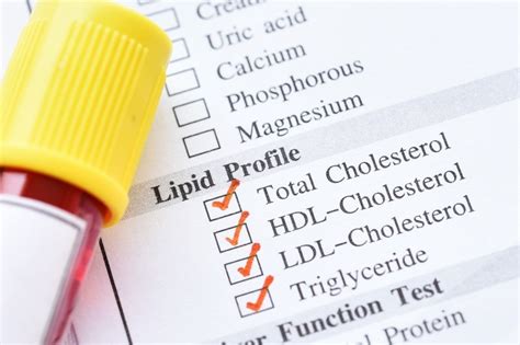 preparing for cholesterol test