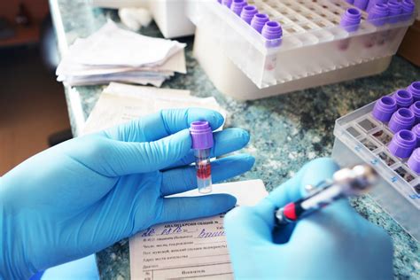 Preparing for CMP Blood Work