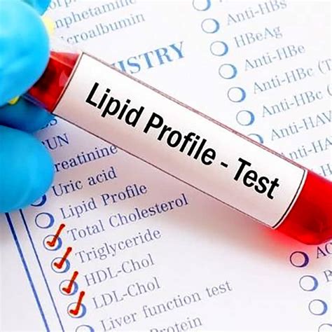 Preparing for a Lipid Blood Test