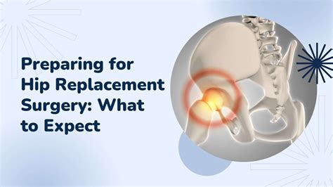 Preparing for Hip Replacement