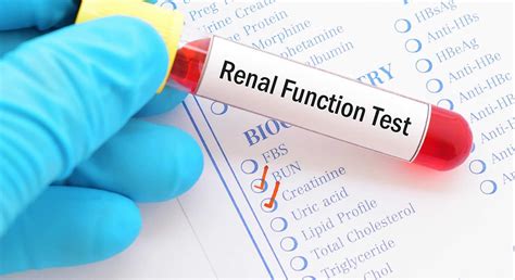 Preparing for Kidney Tests