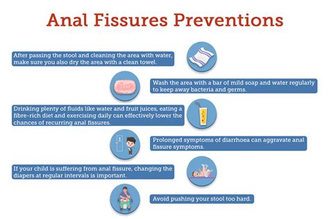 Preventing Anal Fissures