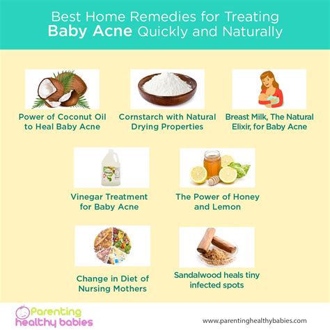 preventing baby acne