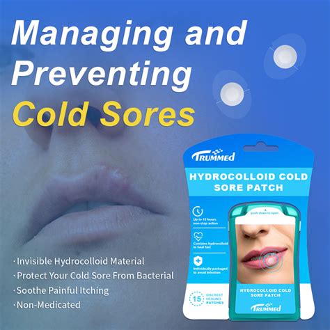 Preventing cold sores