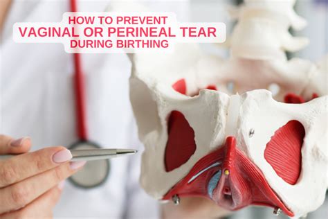 Preventing Future Vaginal Tears