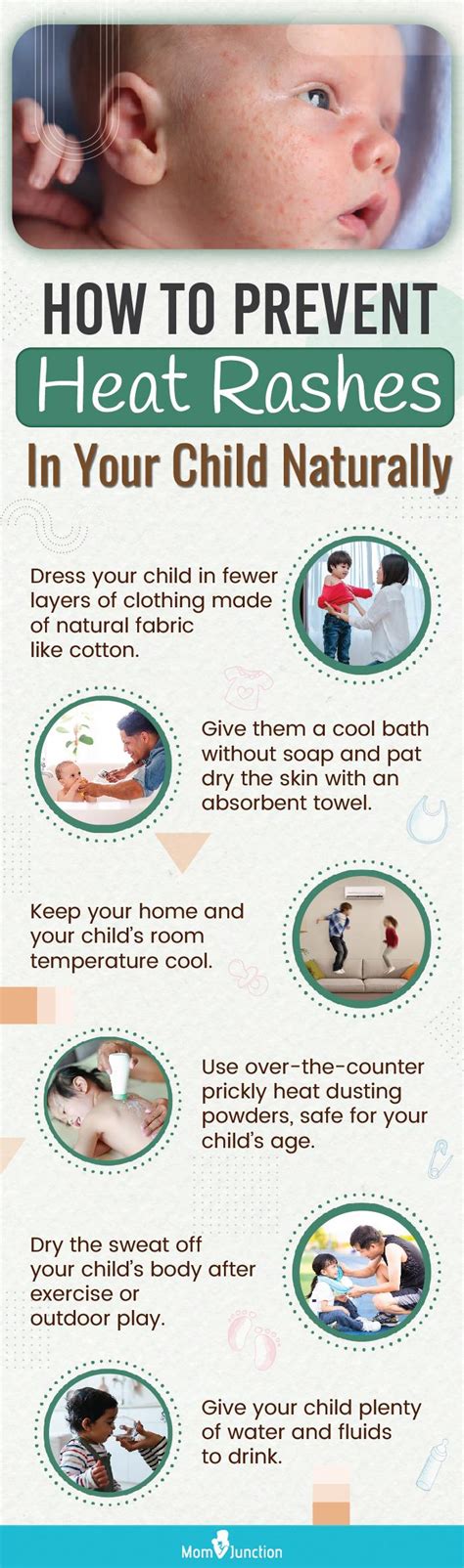 preventing heat rash