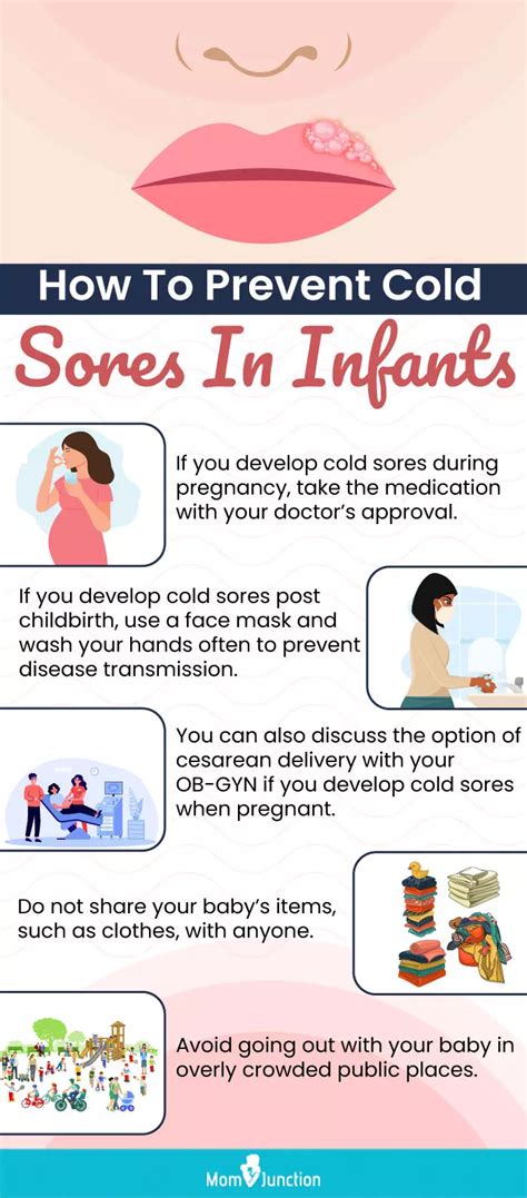 preventing infant cold sores