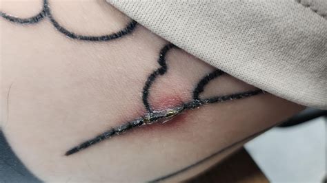 preventing infected tattoos