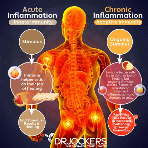 Preventing Inflammation
