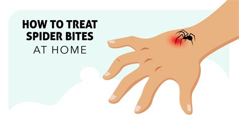 Preventing Spider Bites