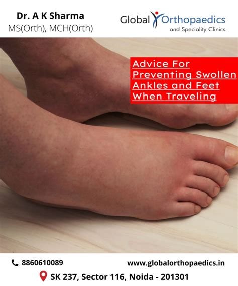 Preventing Swelling
