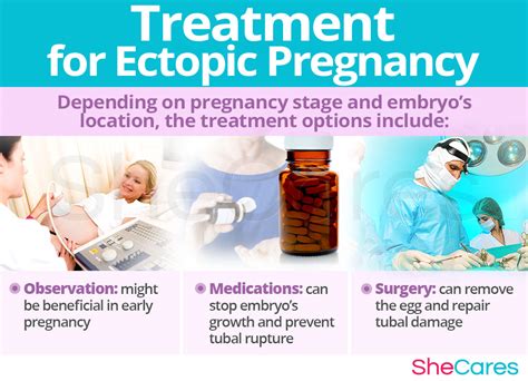 Preventing Tubal Ectopic Pregnancy