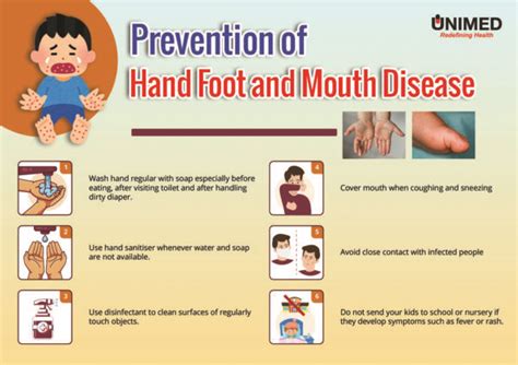Prevention and control of foot-and-mouth disease