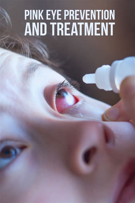 prevention methods for pink eye in infants