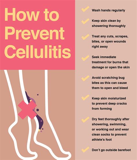prevention of cellulitis on feet