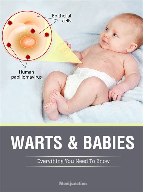 prevention of warts