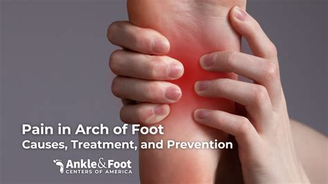Prevention Strategies for Arch Pain