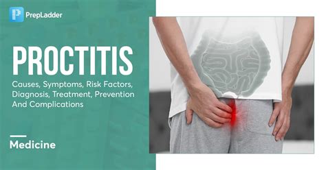 proctitis causes