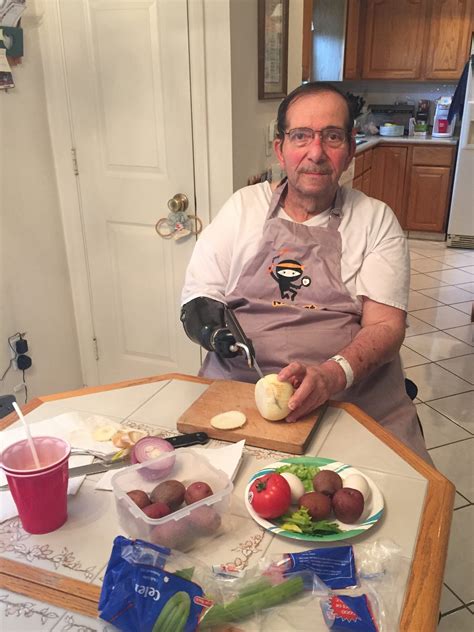 Prosthetic Solutions