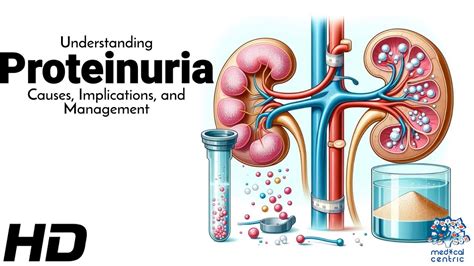 Proteinuria Significance