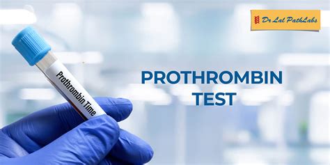 Prothrombin Time Test Procedure
