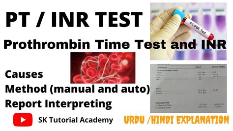 Protime INR Test