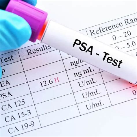PSA Blood Test