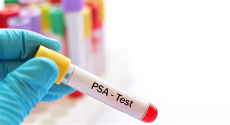 PSA Blood Test Benefits