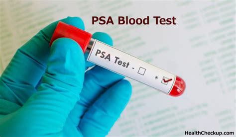 PSA Blood Test Preparation
