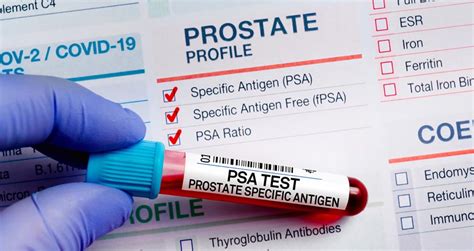 PSA Blood Test Prostatitis
