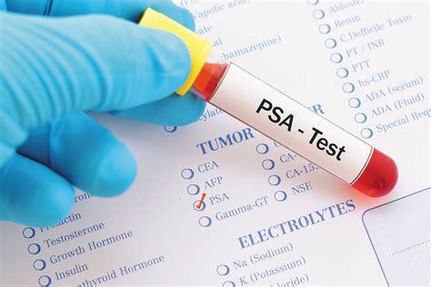 PSA testing
