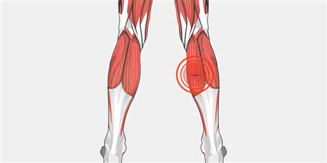pulled calf muscle conclusion