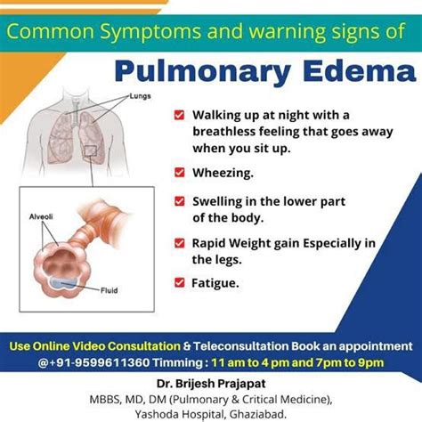 Pulmonary Edema Symptoms