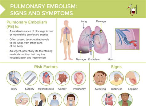 pulmonary embolism diagnosis