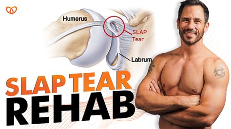 Recovery and Rehabilitation after Slap Tear Injury