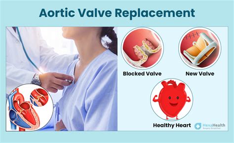Recovery from Aorta Heart Valve Replacement Surgery