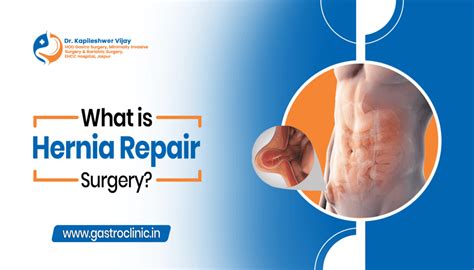 recovery from hernia surgery