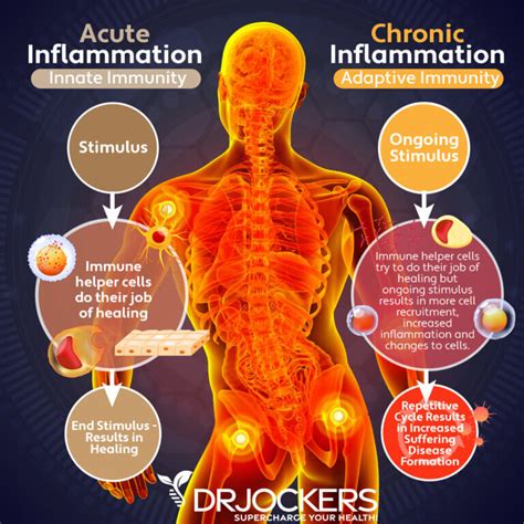 Reducing Inflammation