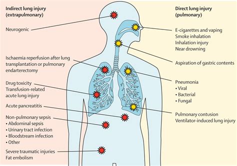Respiratory causes of spitting up blood