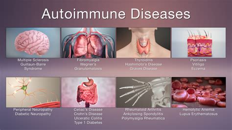 Rheumatoid Factor and Autoimmune Diseases