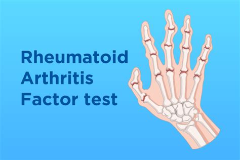Rheumatoid Factor Final Thoughts