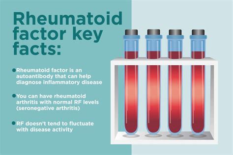 Rheumatoid Factor Research